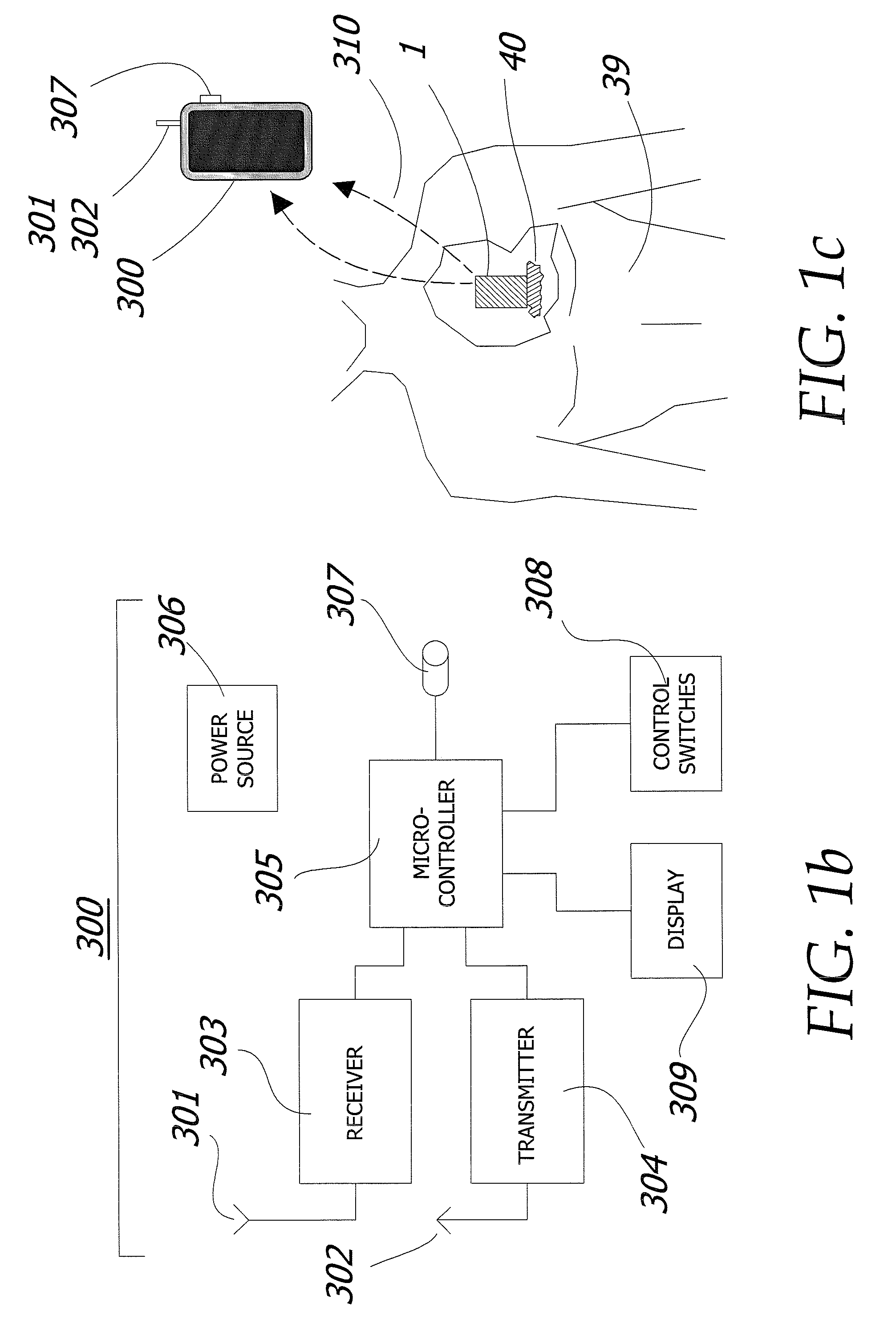 Magnetic Breather Pump and a Method for Treating a Brain Tumor Using the Same