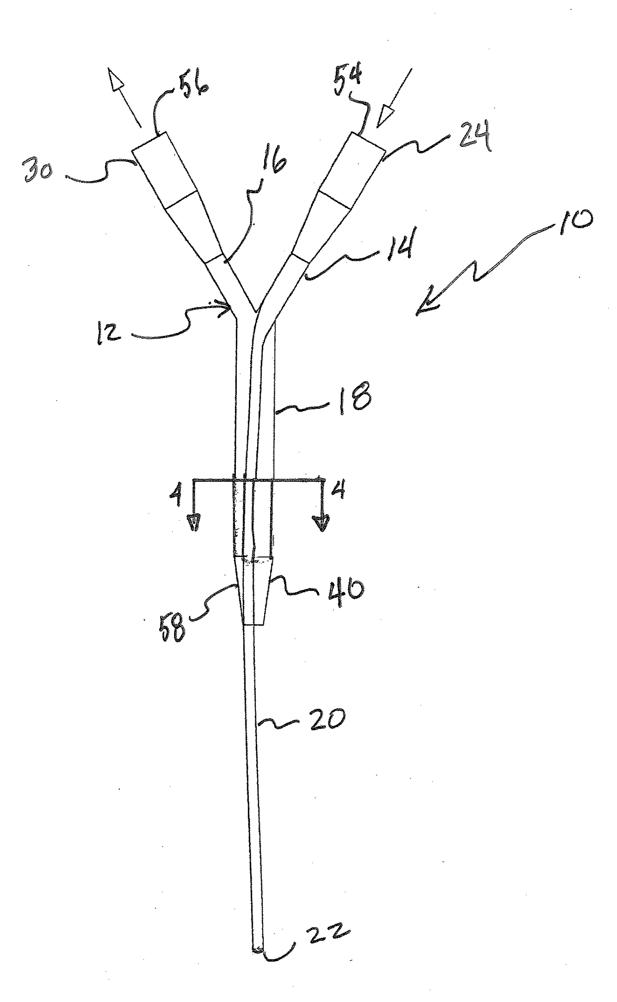 Continuous bladder irrigation adaptor for a foley catheter