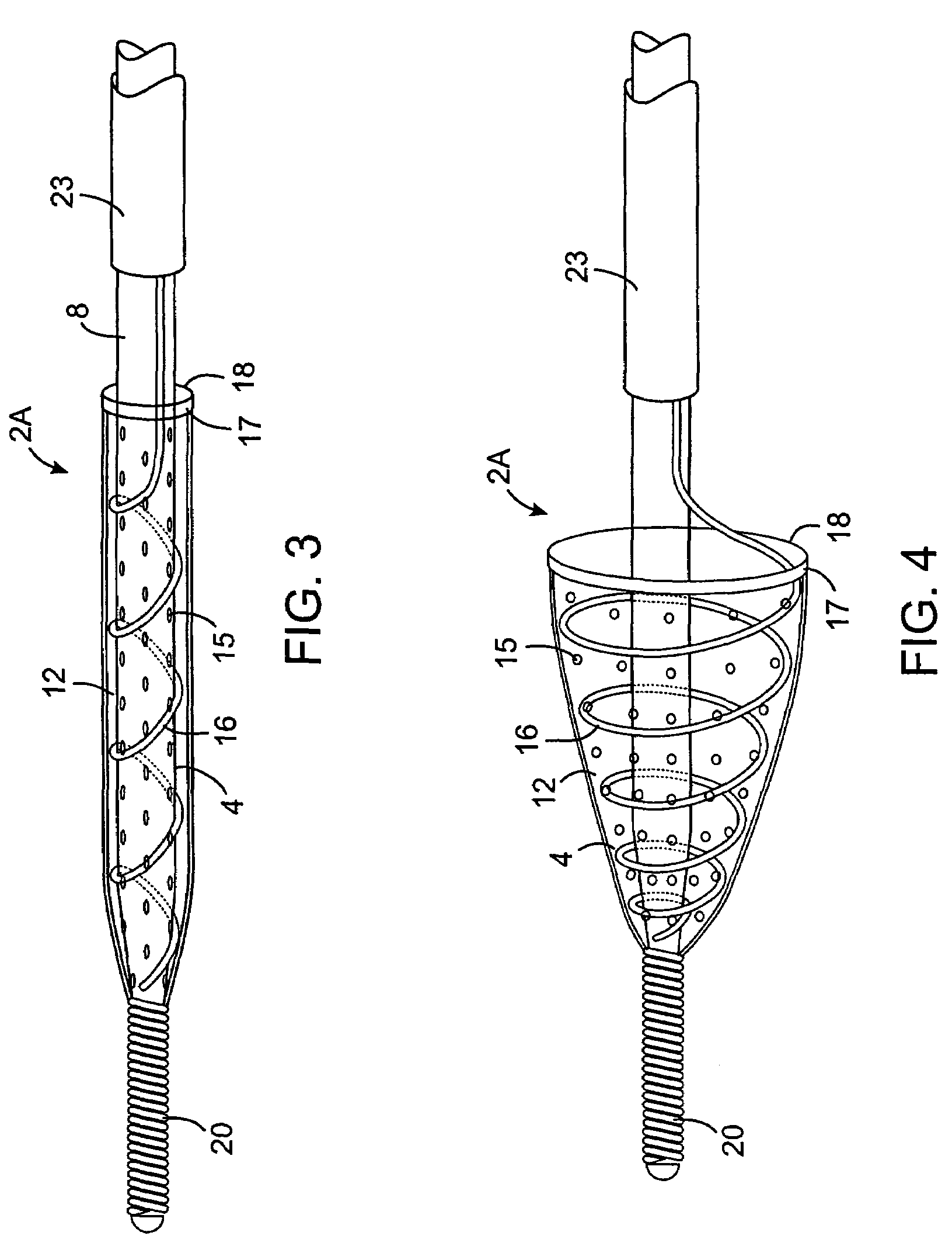 Methods and devices for filtering fluid flow through a body structure