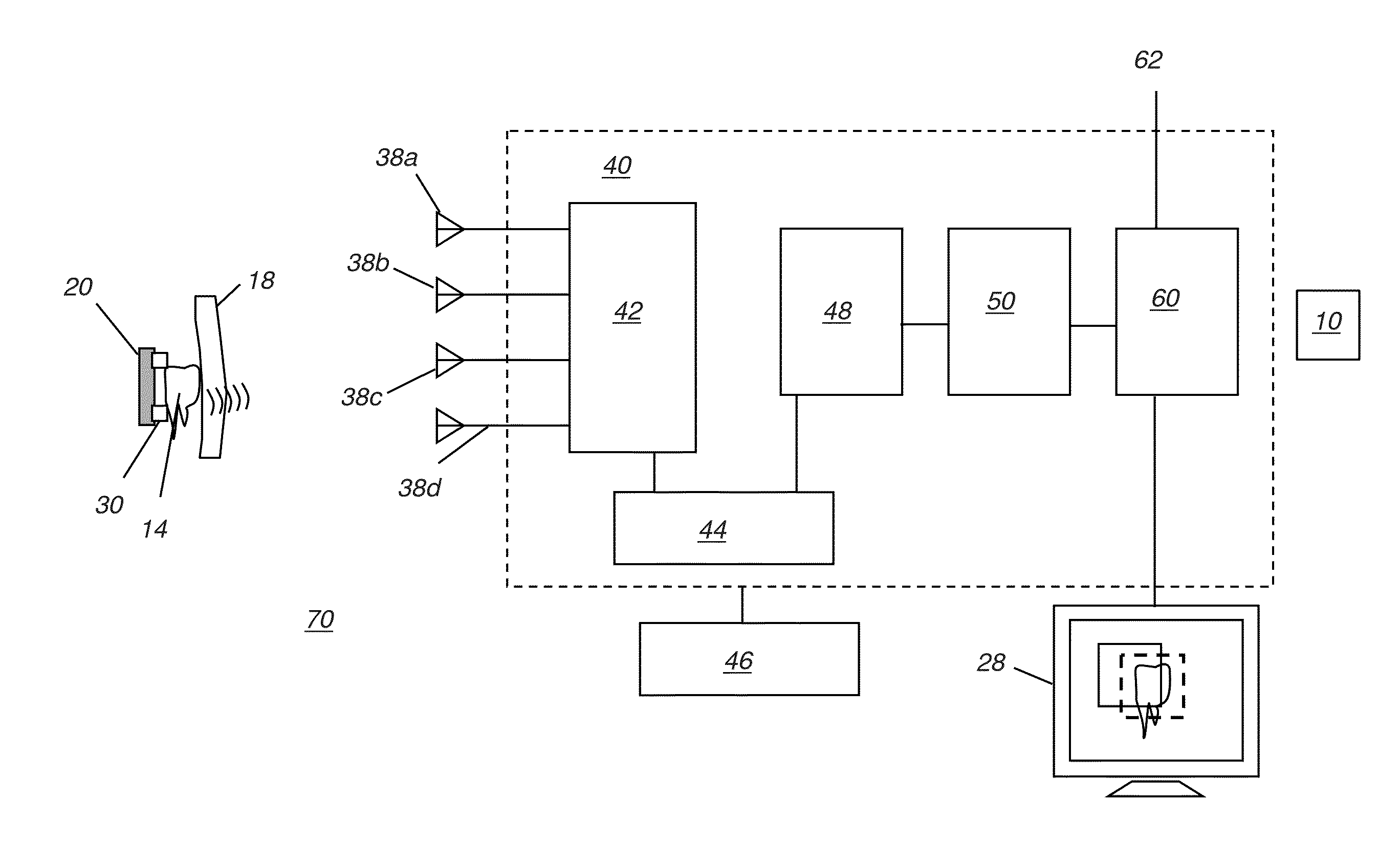 Computed radiography positioning method and system