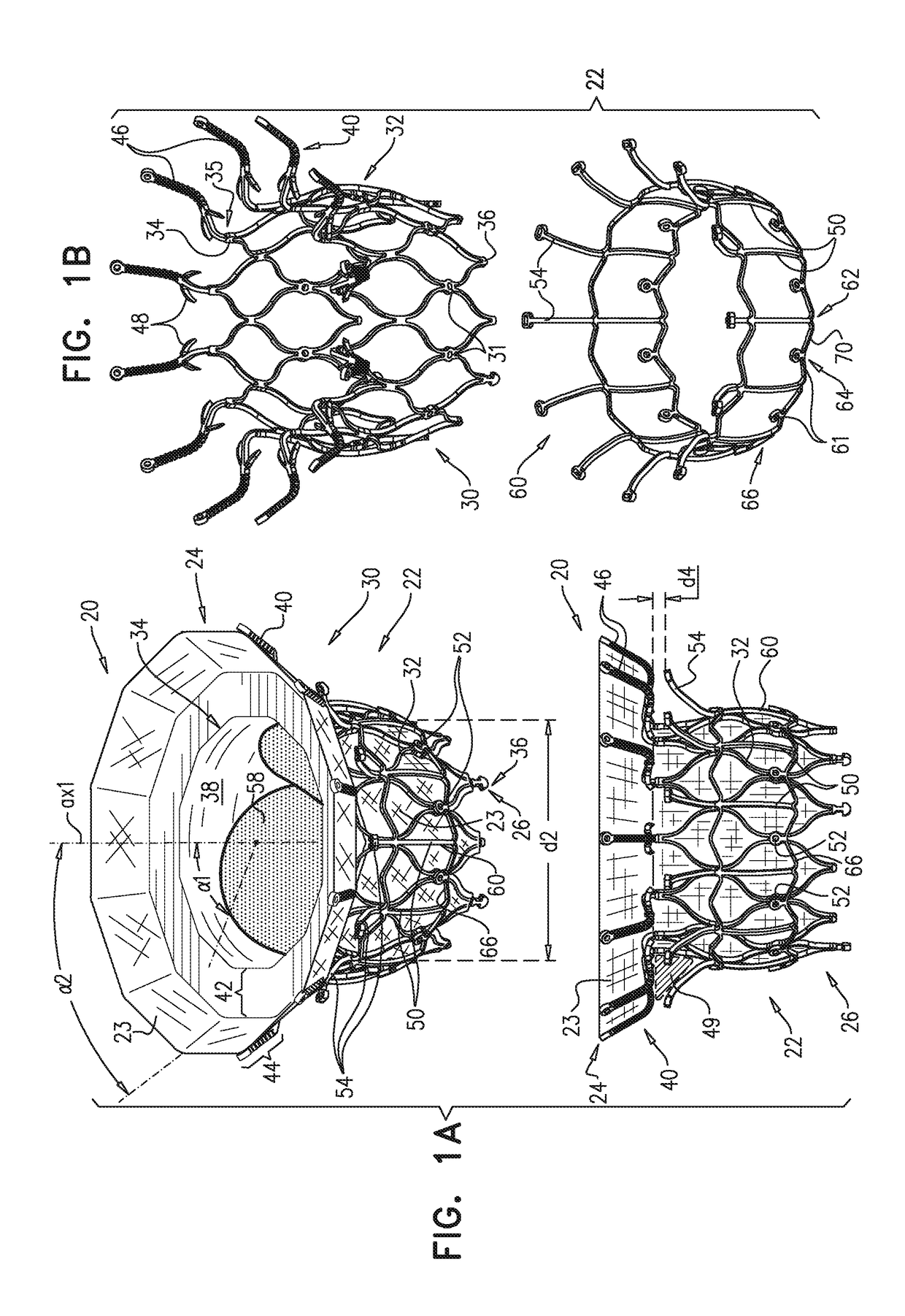 Prosthetic valve with axially-sliding frames