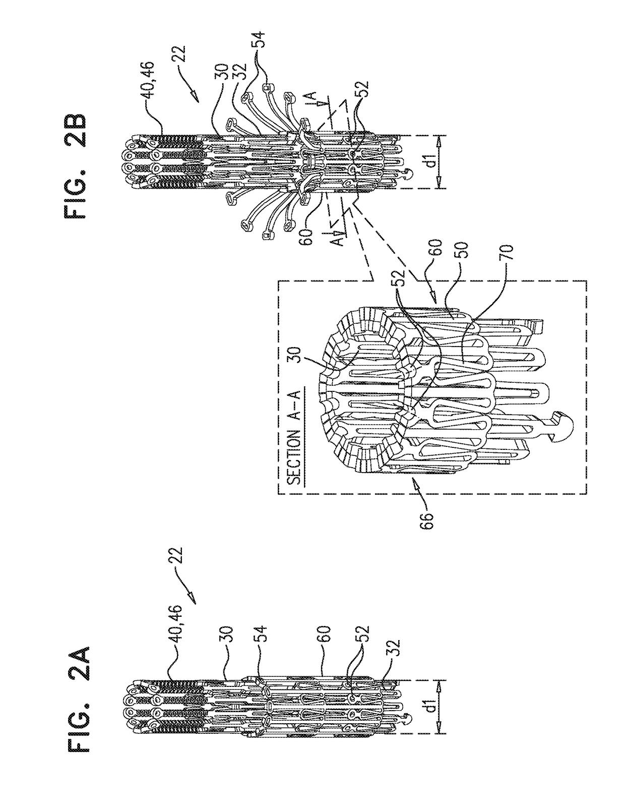 Prosthetic valve with axially-sliding frames