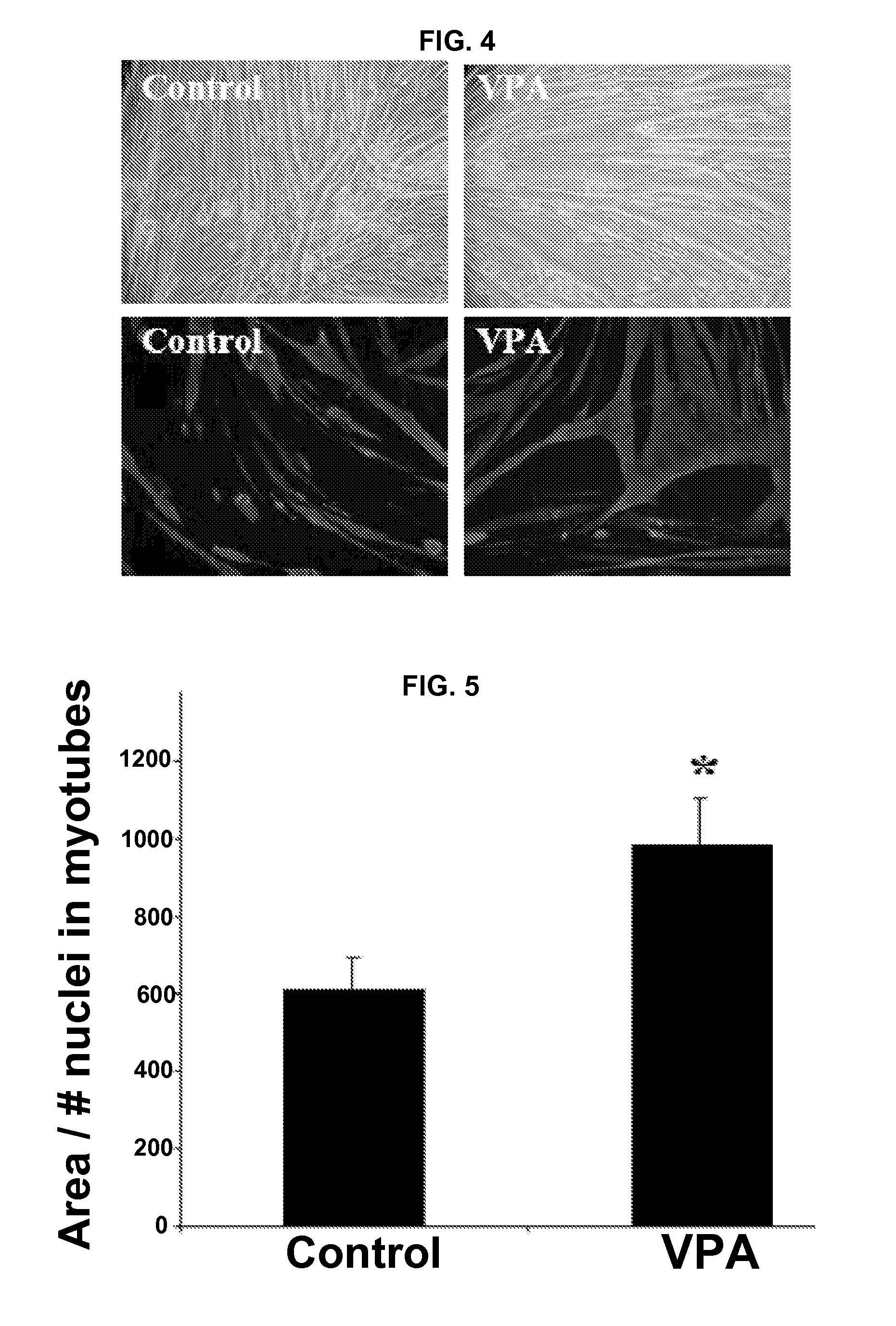 Valproic acid, derivatives, analogues, and compositions including same and methods for their therapeutic use