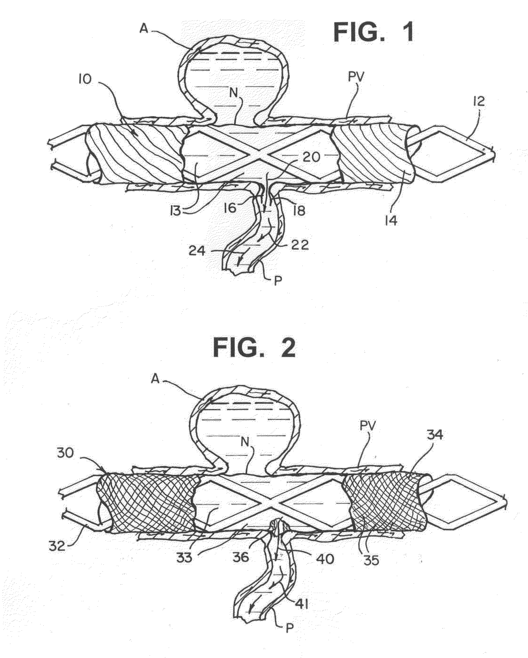Method of fabricating modifiable occlusion device
