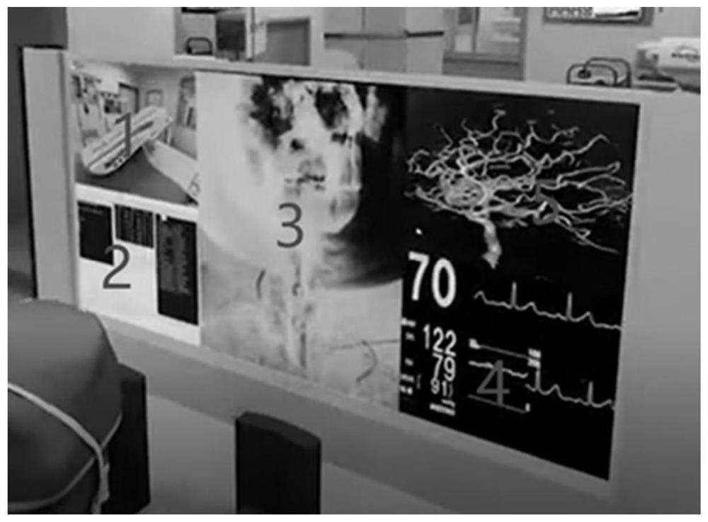 An automatic remote contrast surgery robot system