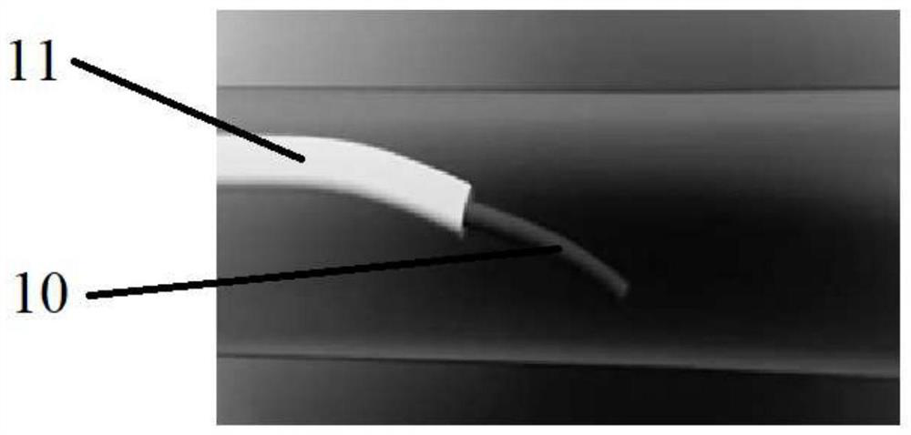 An automatic remote contrast surgery robot system