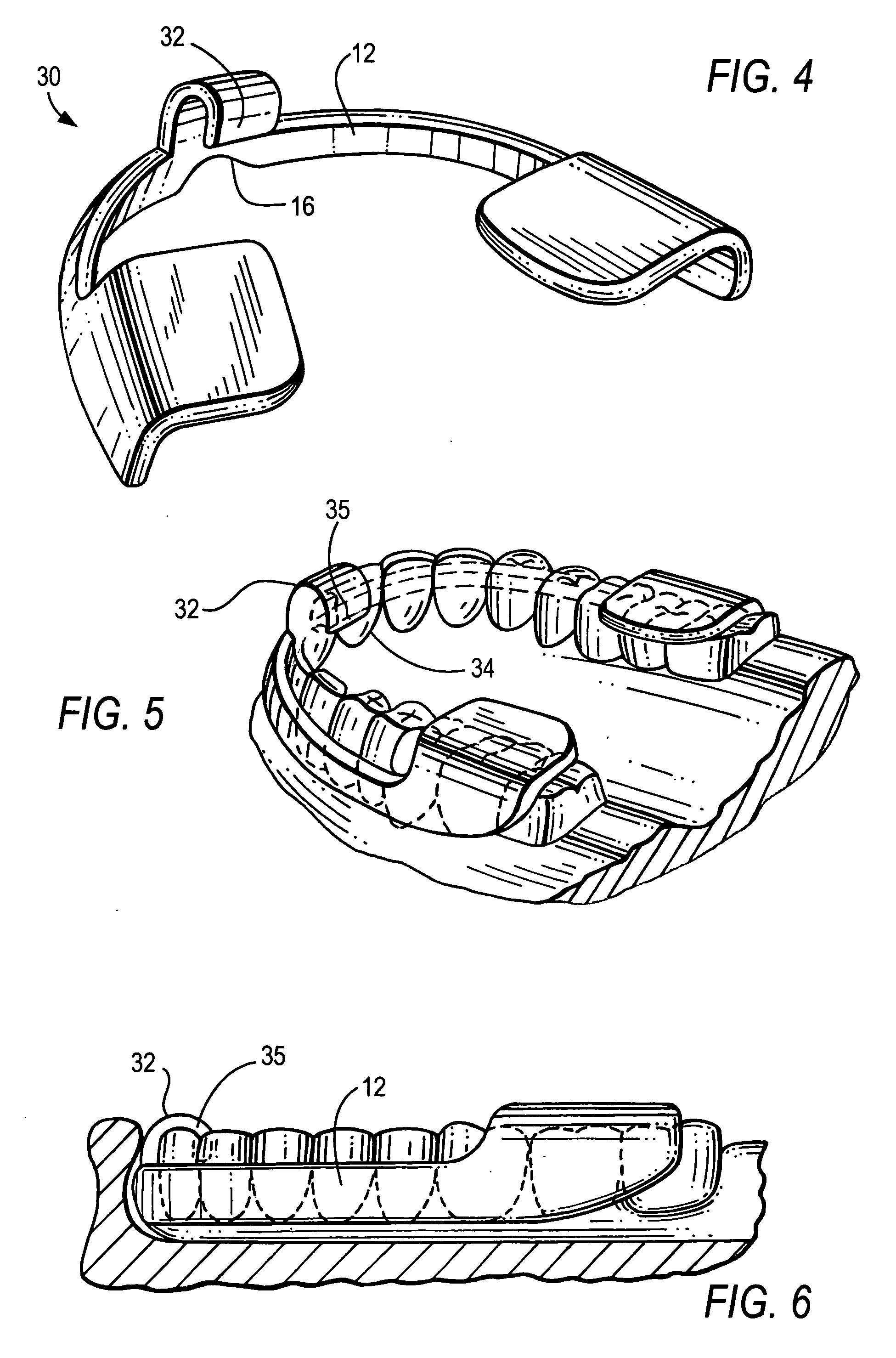 Bruxism protective device