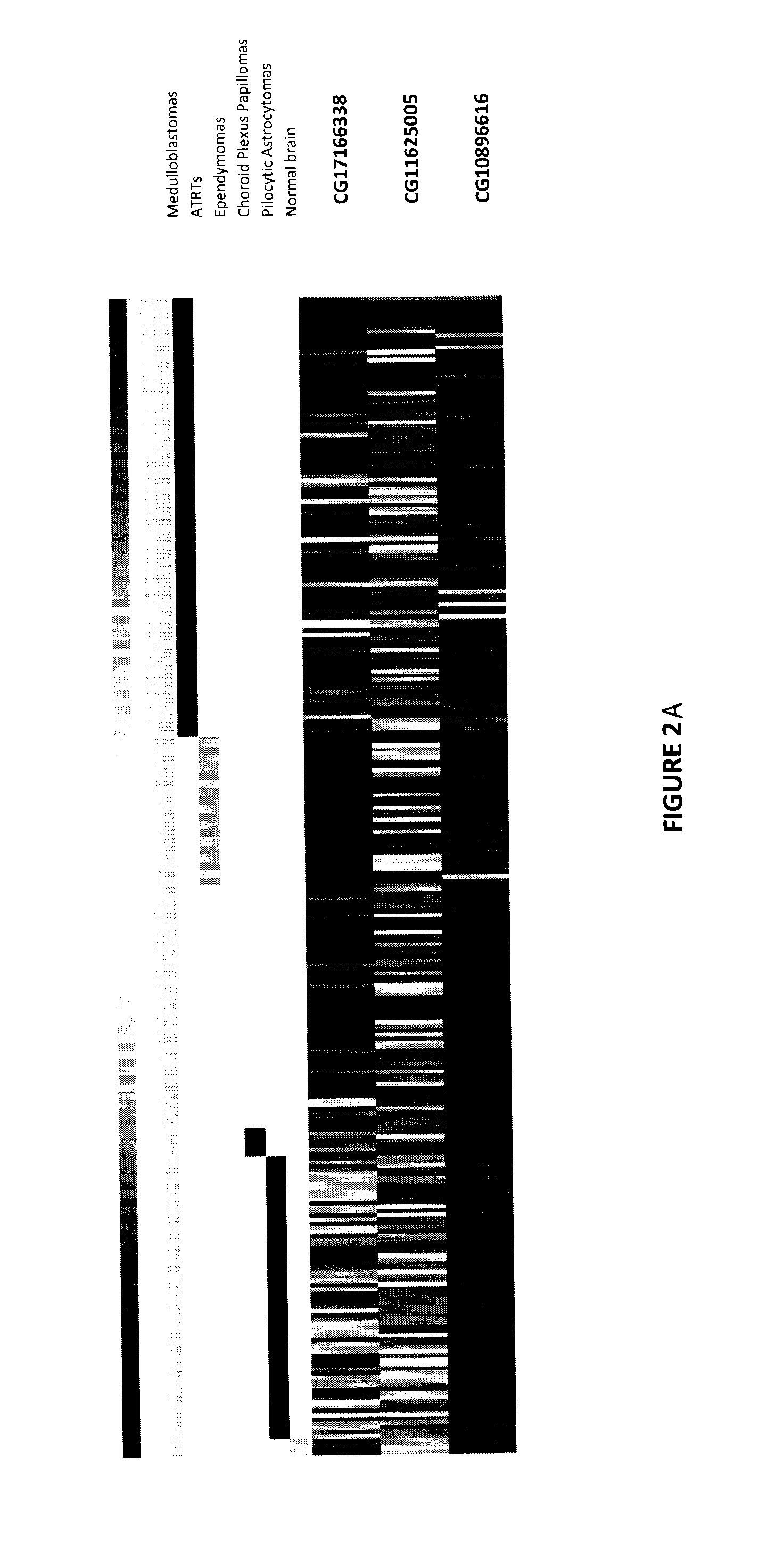 Method of diagnosing cancer comprising detection of the methylation signature in the htert promoter