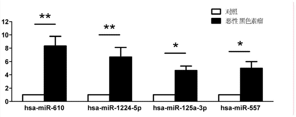 Plasma/serum circulation microRNA marker related to mlignnt melnom and application of marker