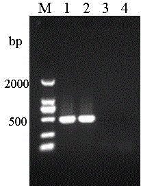 Application of EB1 gene to detection of nosema bombycis