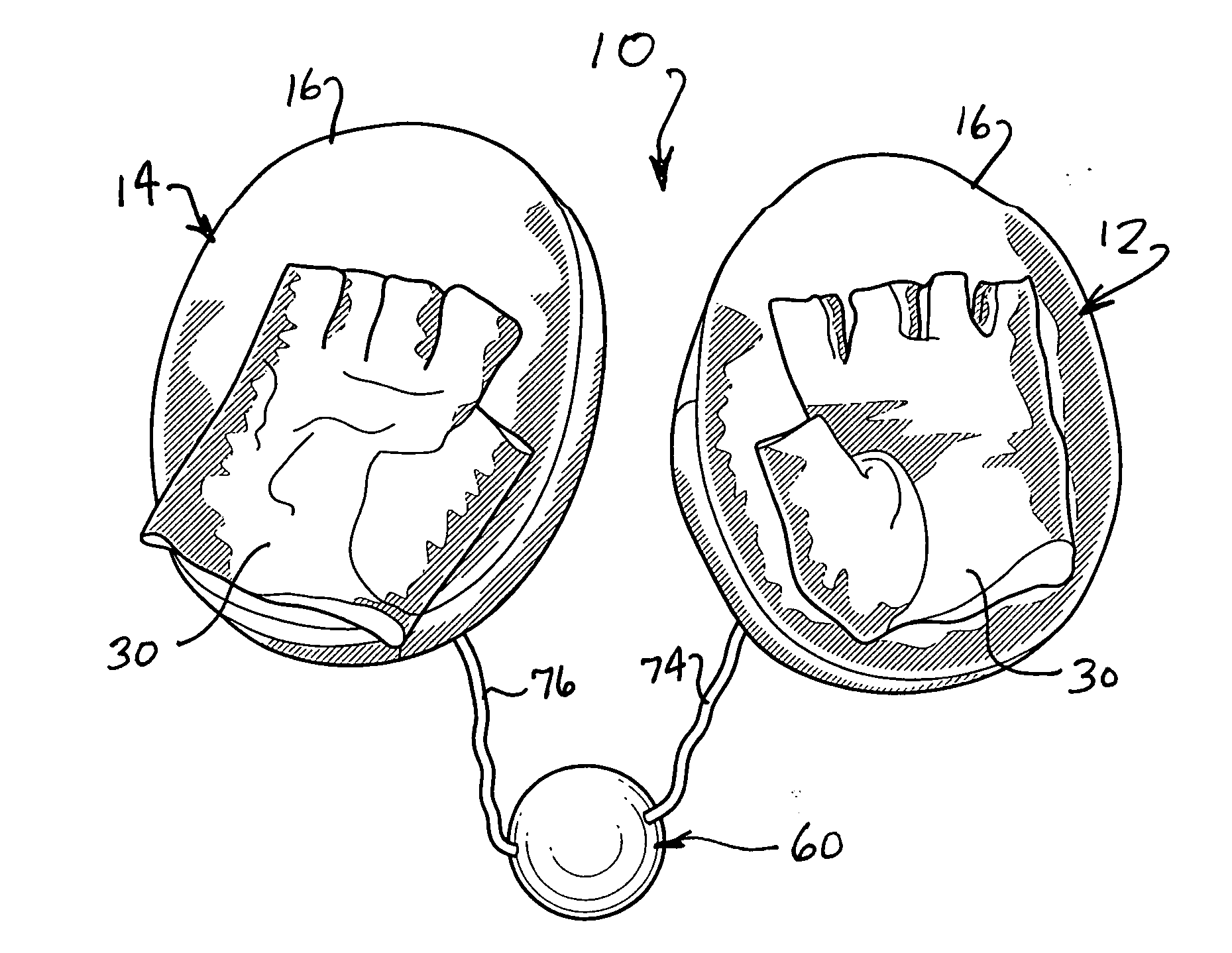 Boxing exercise device