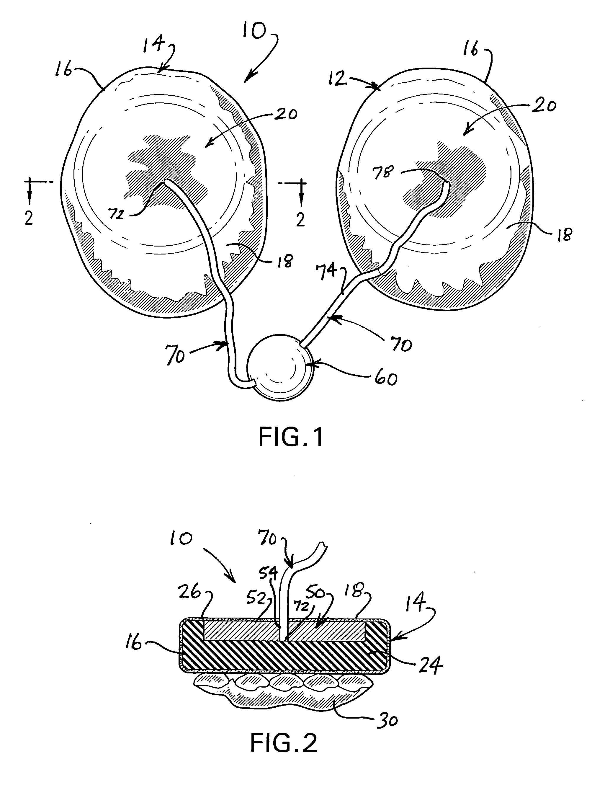 Boxing exercise device