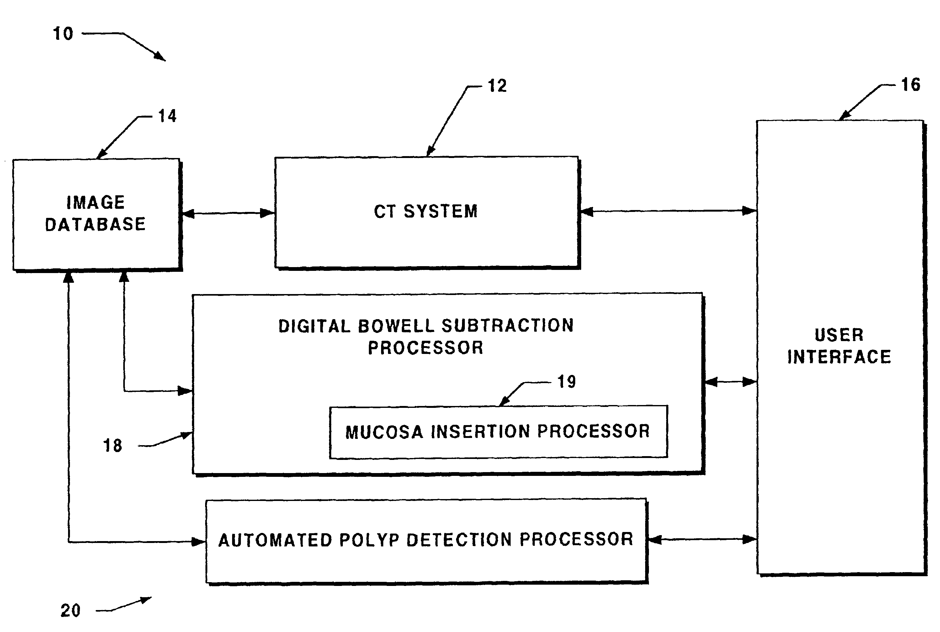 System for digital bowel subtraction and polyp detection and related techniques
