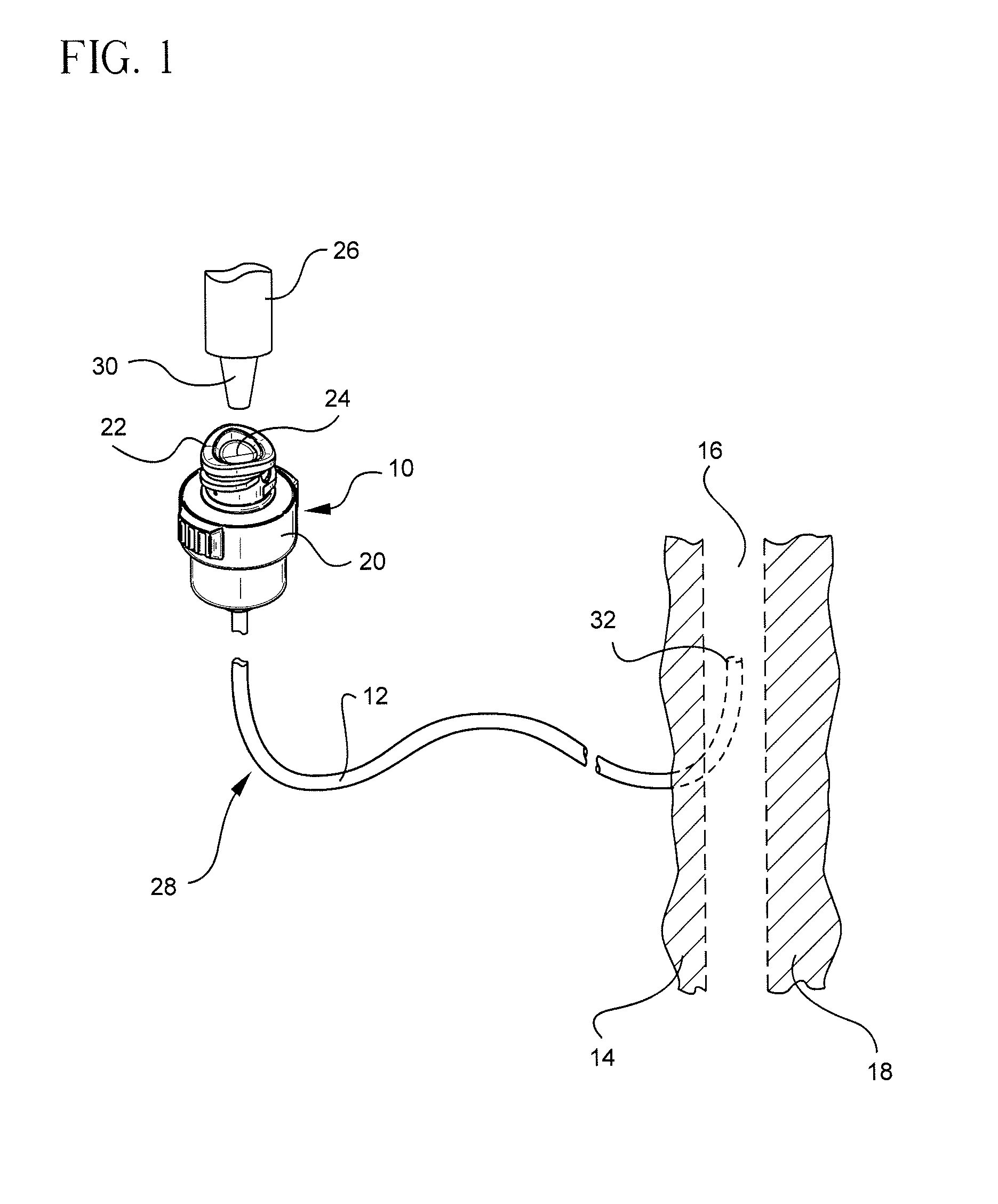 Vascular access device including a tear-resistant septum