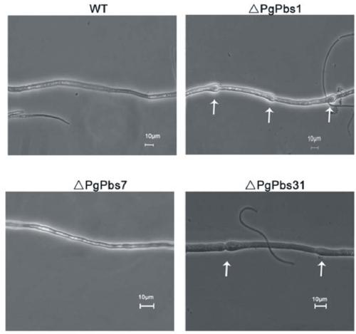 Barley stripe pathogenic gene PgPBS and applications thereof