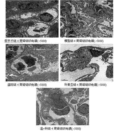 Yang warming and blood activating traditional Chinese compound preparation for preventing and treating chronic kidney diseases and application thereof