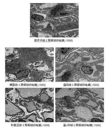 Yang warming and blood activating traditional Chinese compound preparation for preventing and treating chronic kidney diseases and application thereof