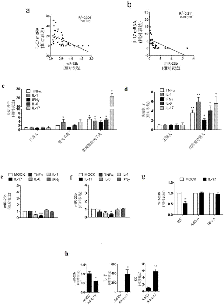 microRNA related to autoimmune disease and application thereof