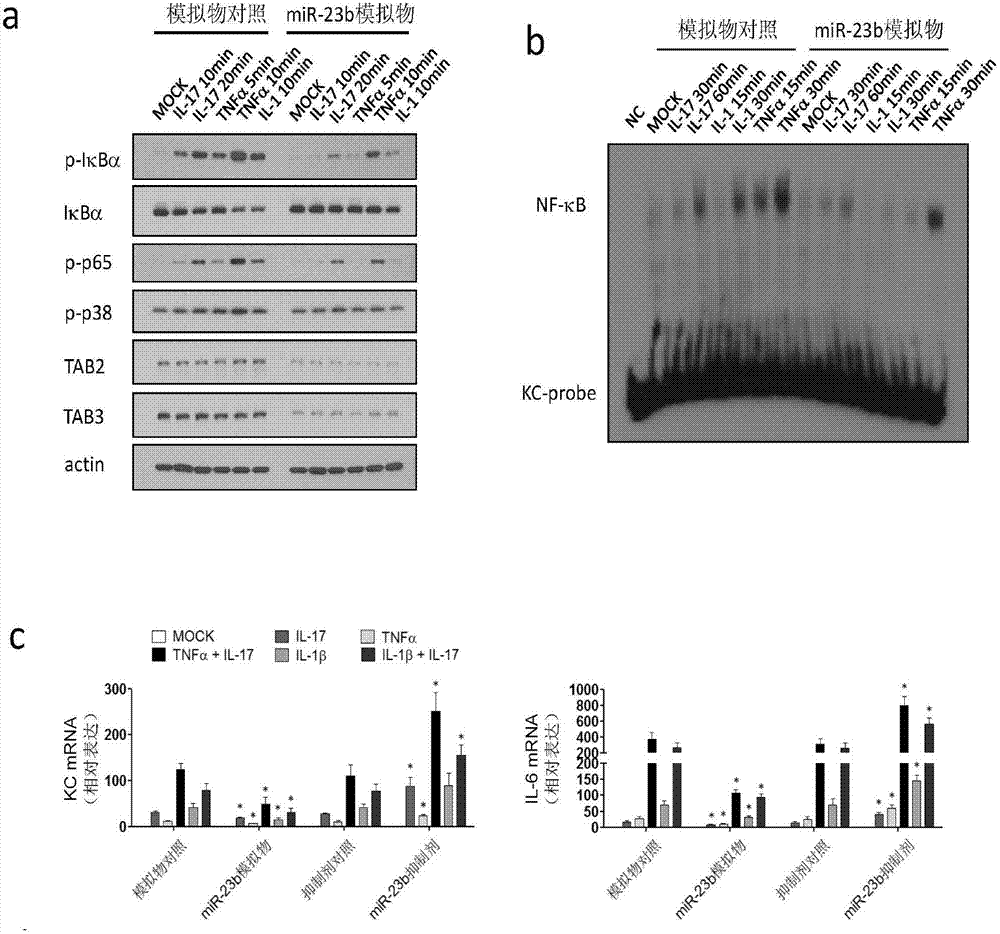 microRNA related to autoimmune disease and application thereof