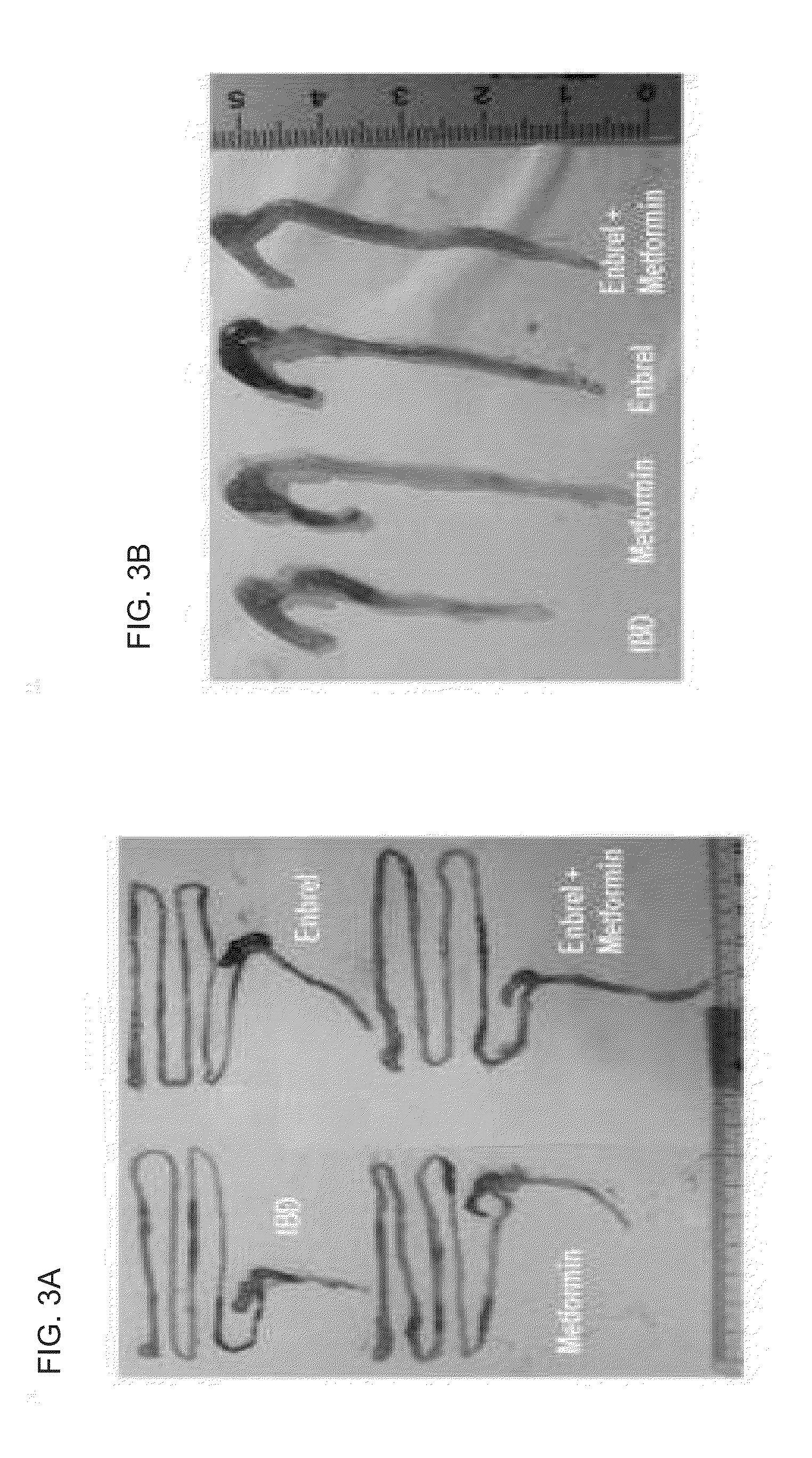 Composition comprising metformin as active ingredient for preventing or treating inflammatory bowel disease