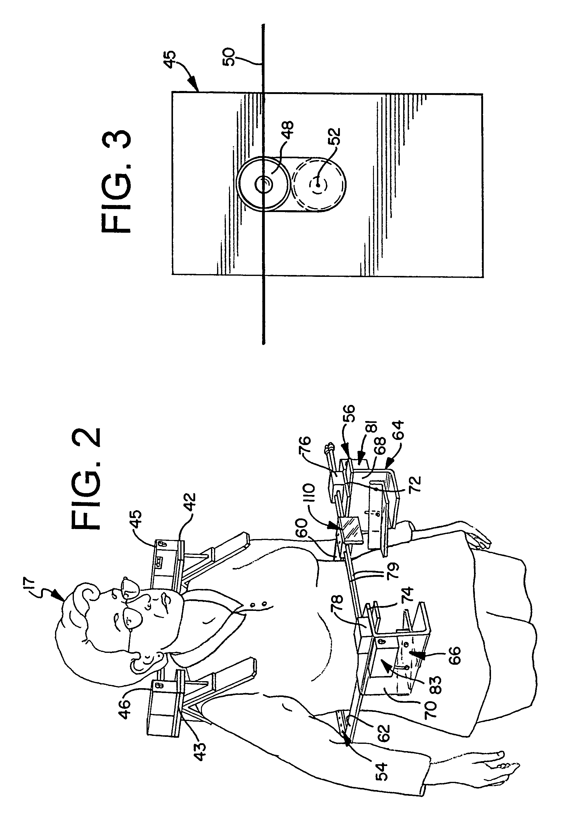Method and apparatus for measuring spinal distortions
