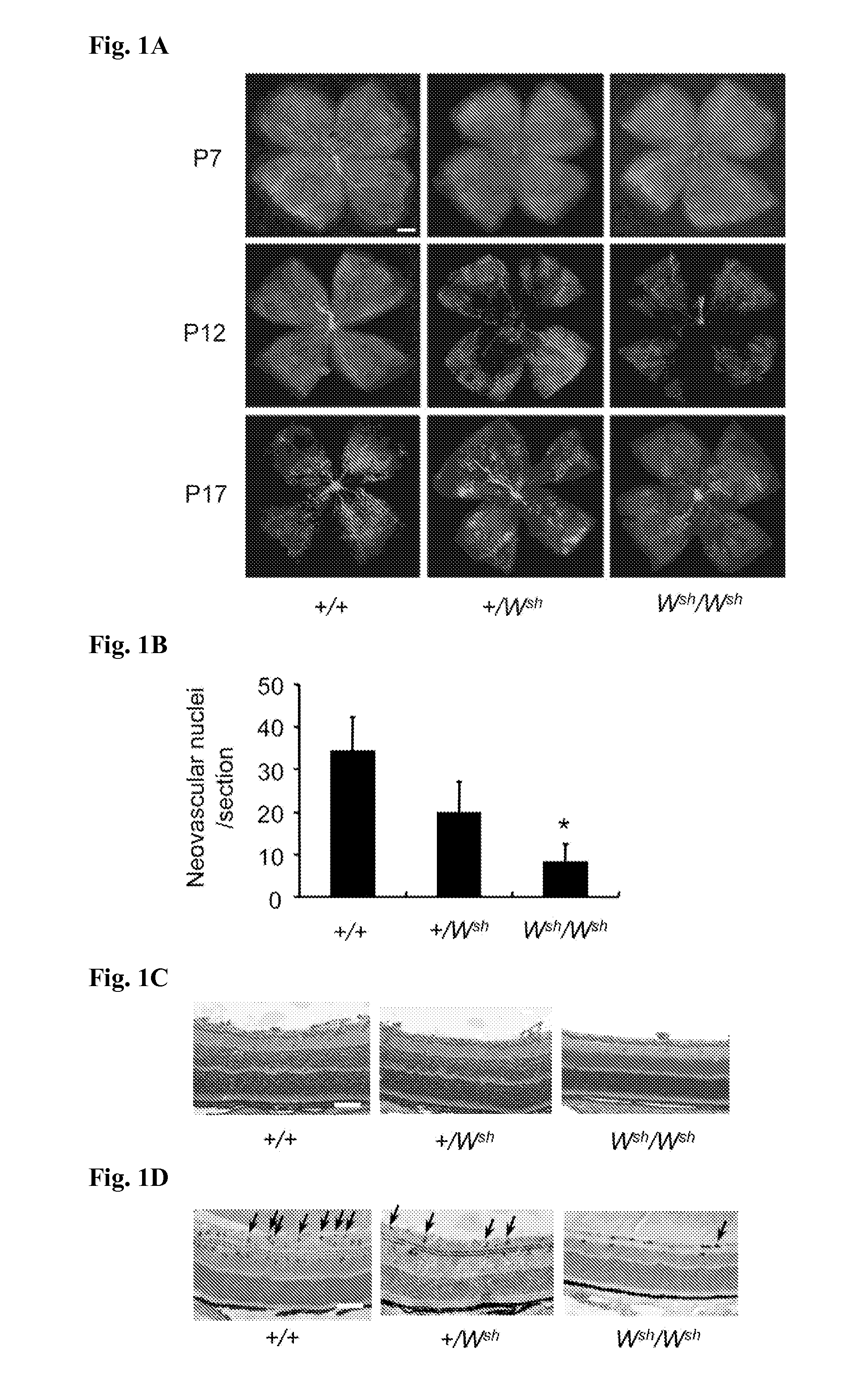 Therapeutic or prophylactic agent for retinopathy of prematurity, testing method for retinopathy of prematurity, and screening method for therapeutic or prophylactic substance for retinopathy of prematurity