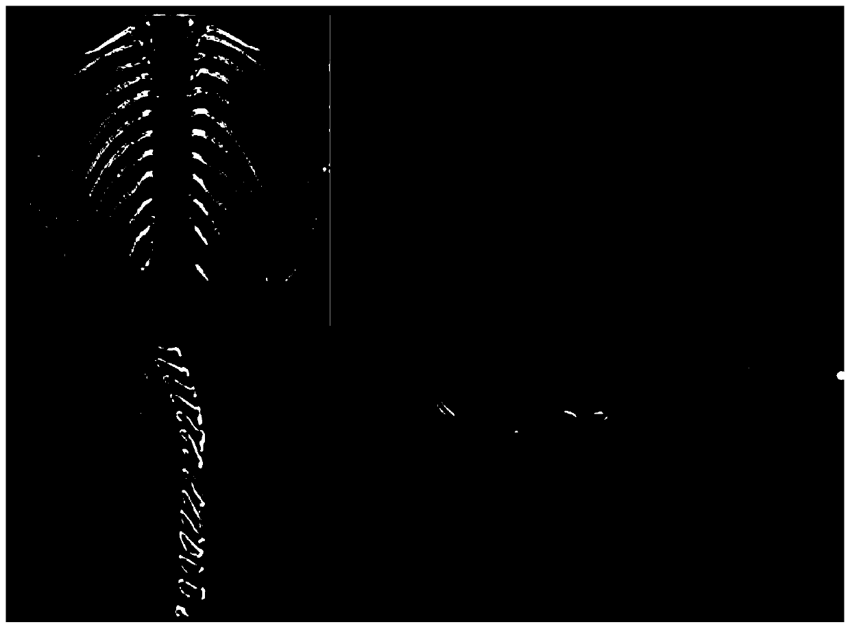 Medical image processing method and device