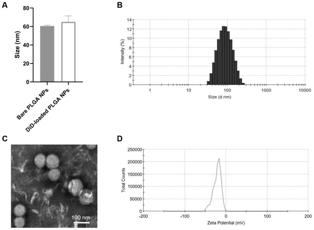 Preparation and application of Pluronic-F127 hydrogel loaded nano sponge detoxification system