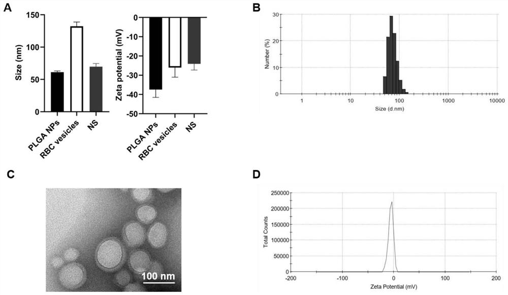 Preparation and application of Pluronic-F127 hydrogel loaded nano sponge detoxification system