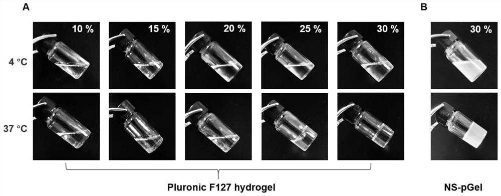 Preparation and application of Pluronic-F127 hydrogel loaded nano sponge detoxification system