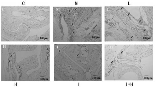 Use of total saponins of panax japonicas in preparing medicine for treating rheumatoid arthritis angiogenesis