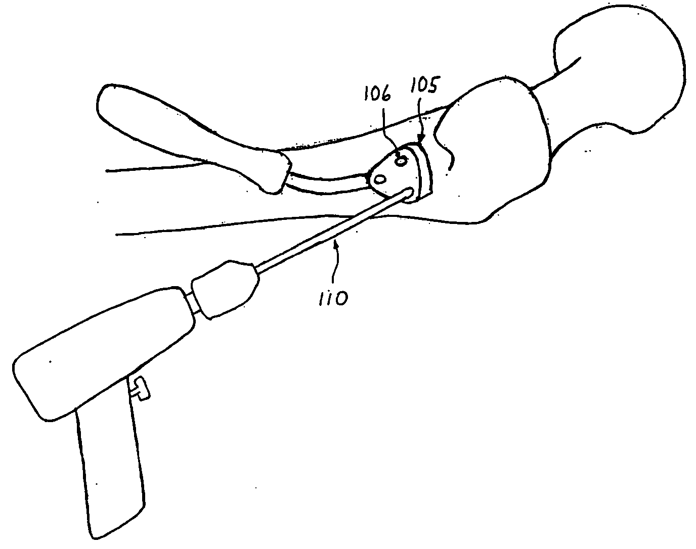 Enhanced graphic features for computer assisted surgery system