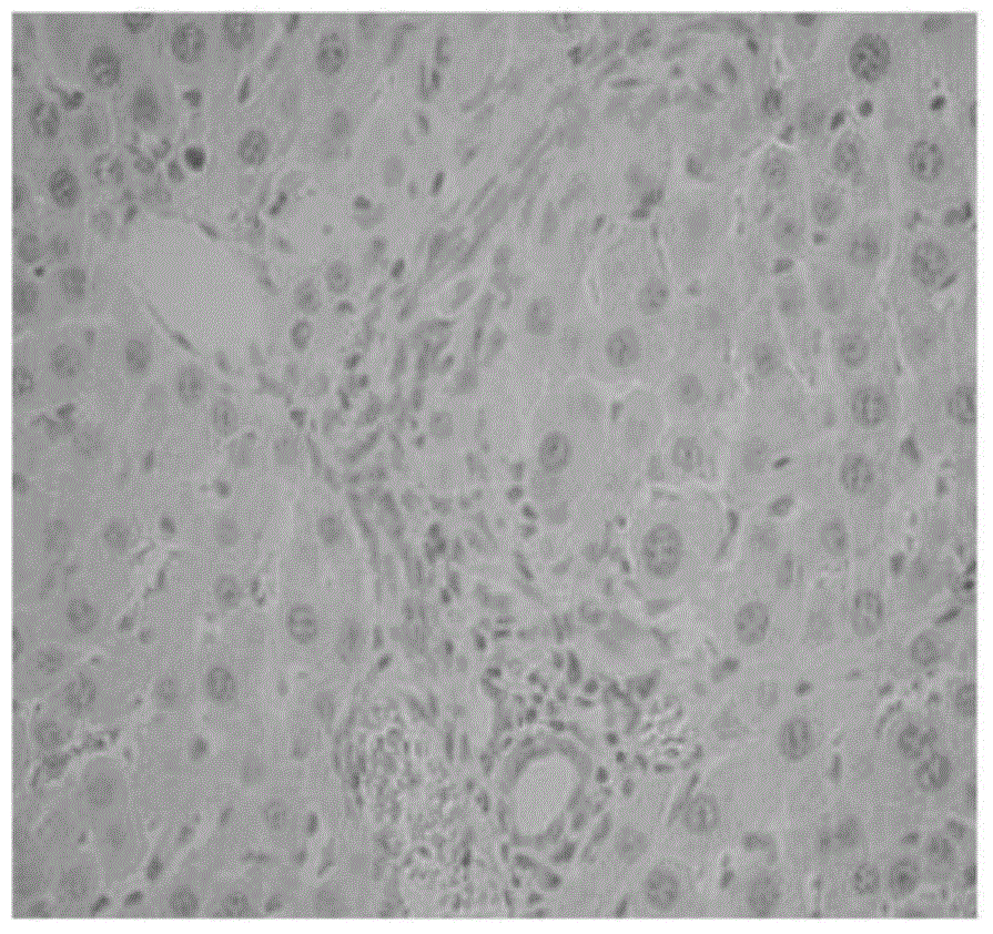 Novel application of acanthopanax polysaccharide