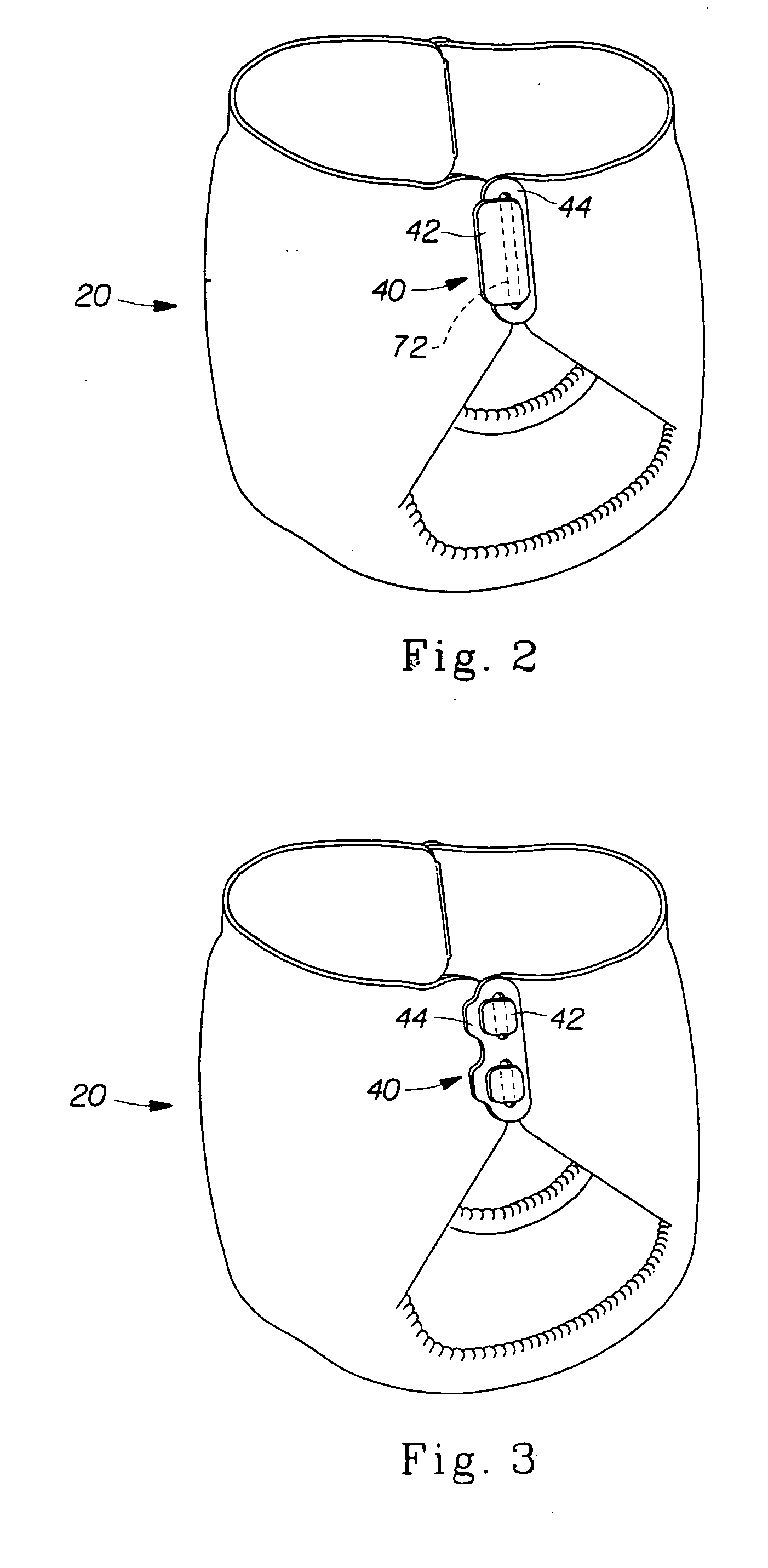 Absorbent article fastening device