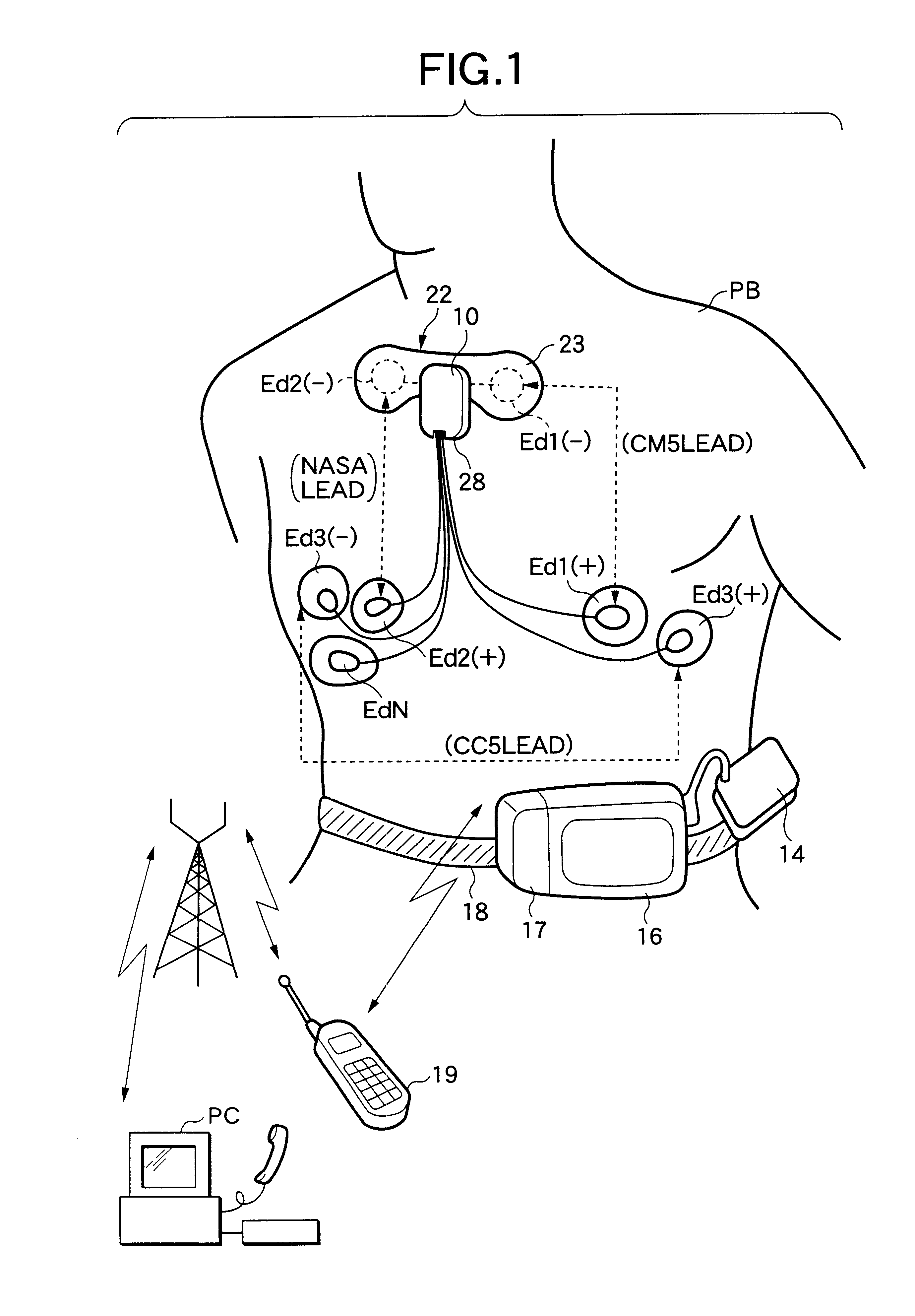 Biological signal detection apparatus Holter electrocardiograph and communication system of biological signals