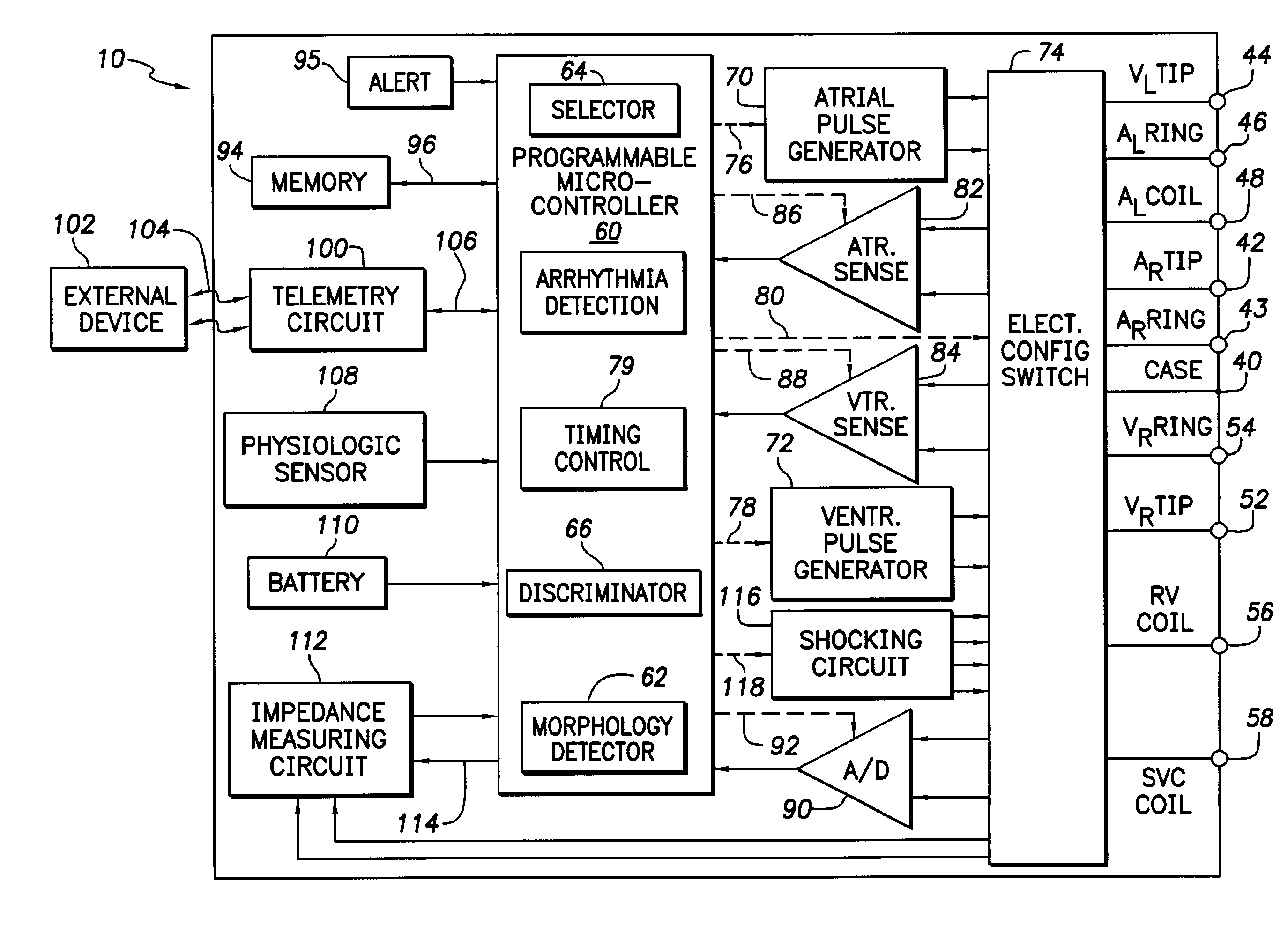 Implantable cardiac device having a system for detecting T wave alternan patterns and method