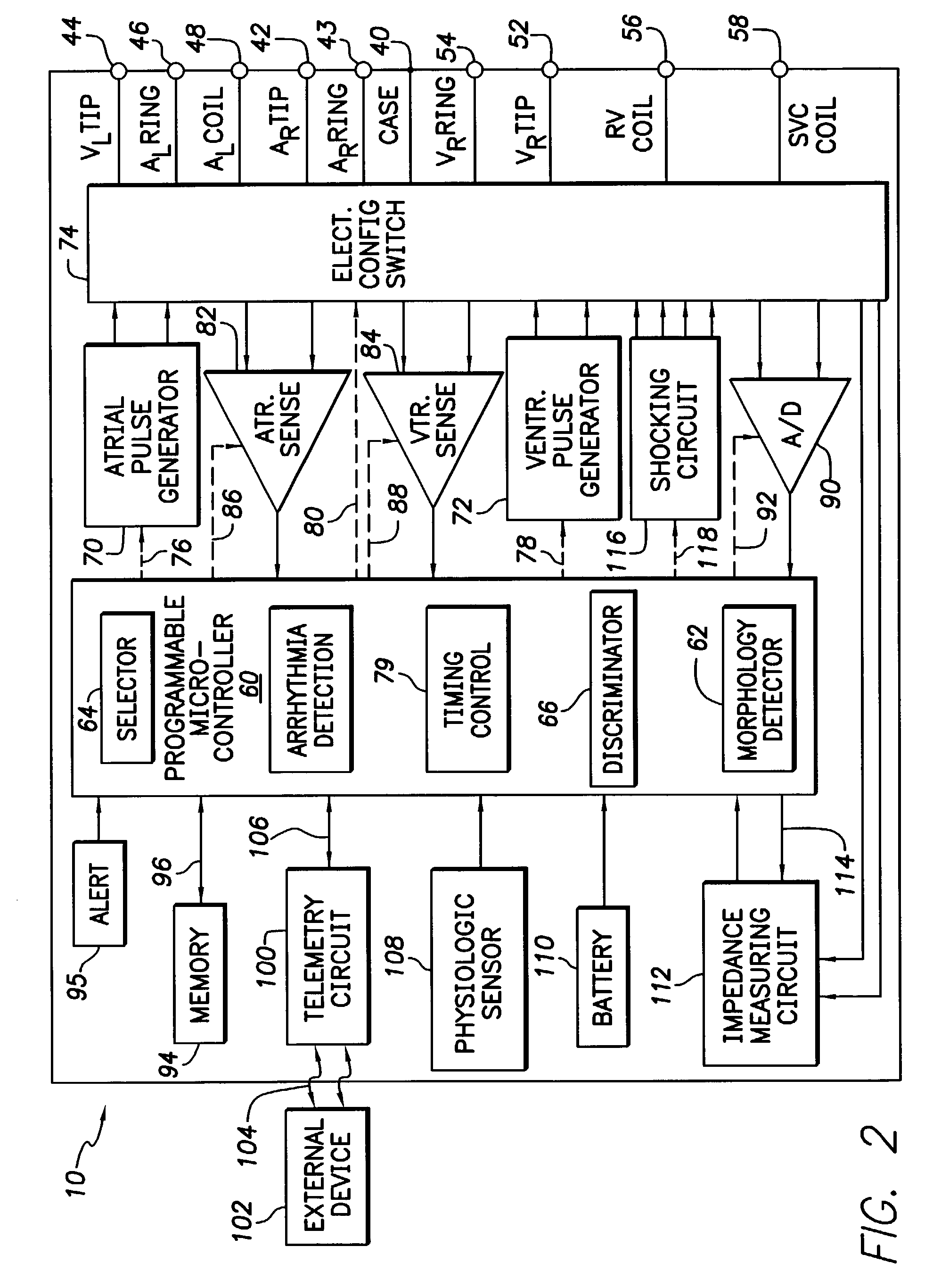 Implantable cardiac device having a system for detecting T wave alternan patterns and method