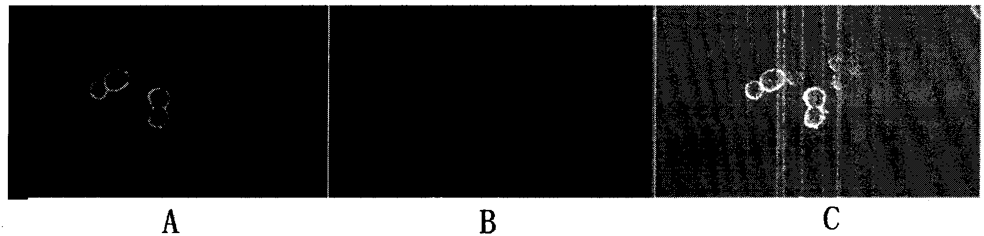 HPV58 (Human Papilloma Virus) type therapeutic composite genetic vaccine and construction method thereof