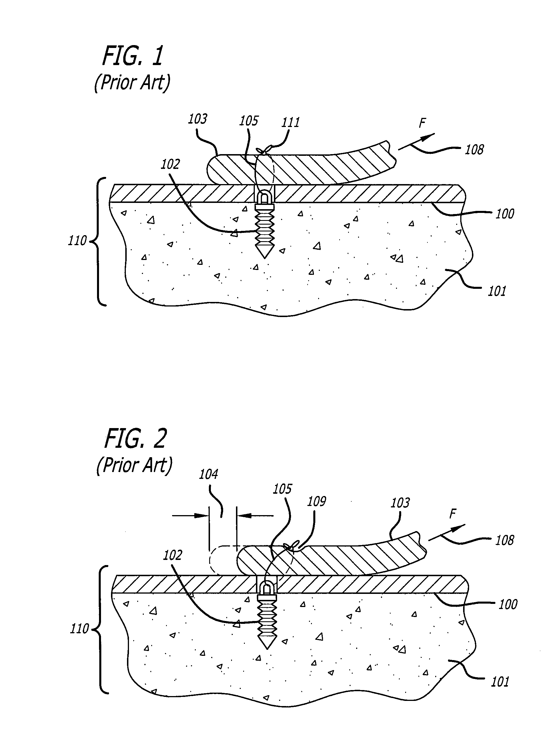 Knotless suture anchor for soft tissue repair and method of use