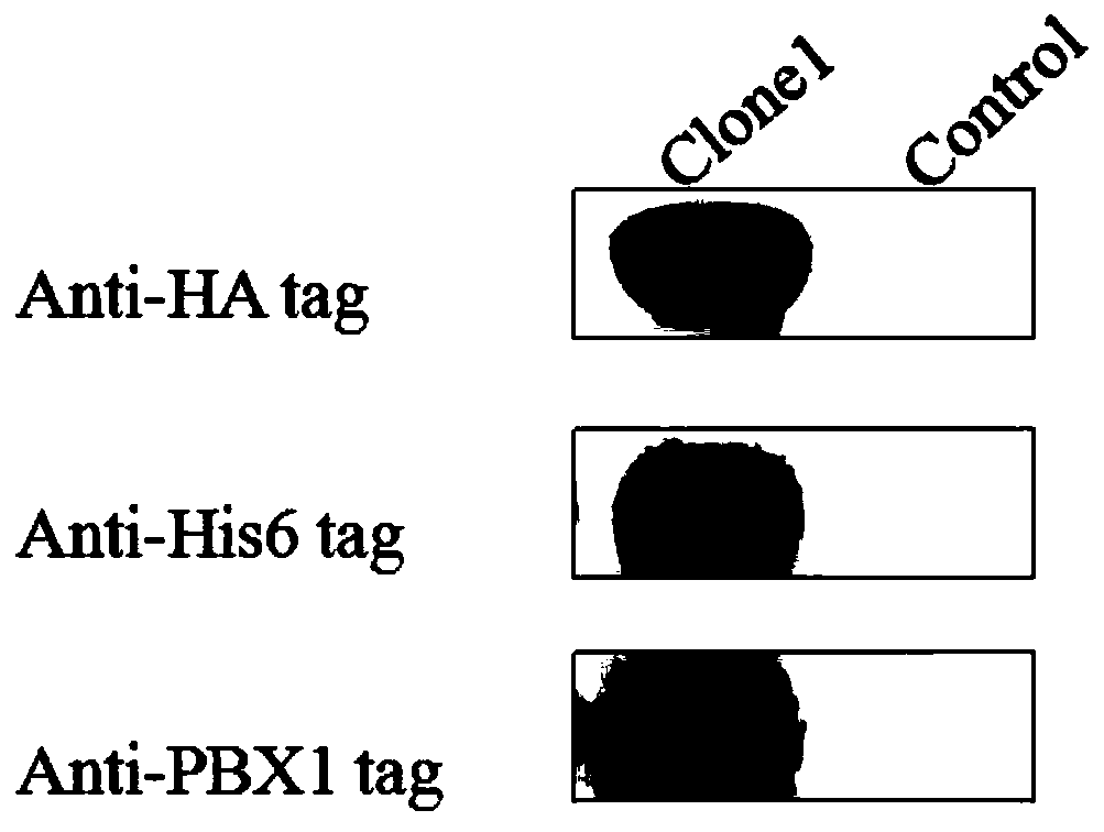 Cell-penetrating peptide-pre-B cell leukemia transcription factor 1 fusion protein and preparation method and application thereof