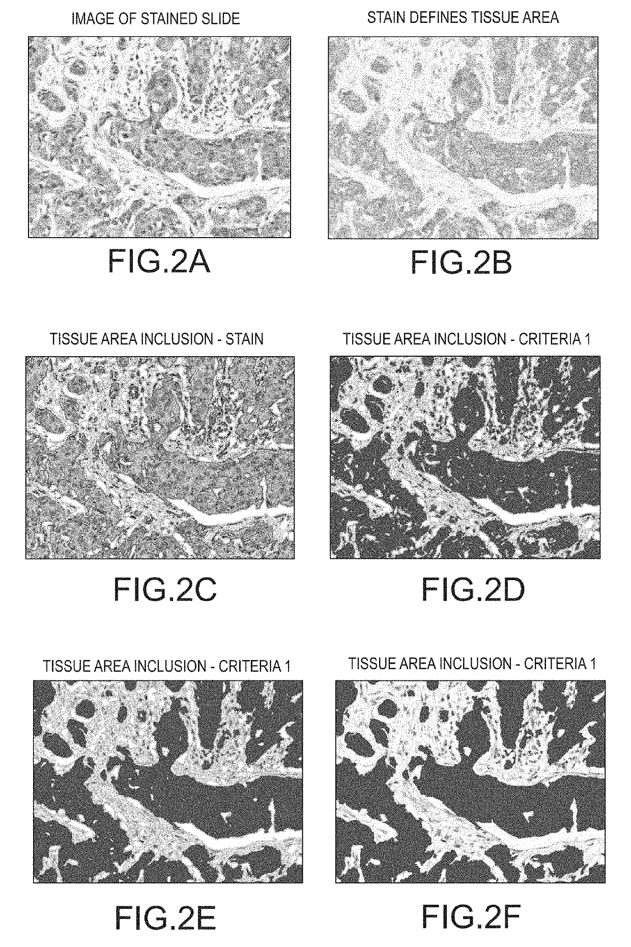 Method for assigning tissue normalization factors for digital image analysis