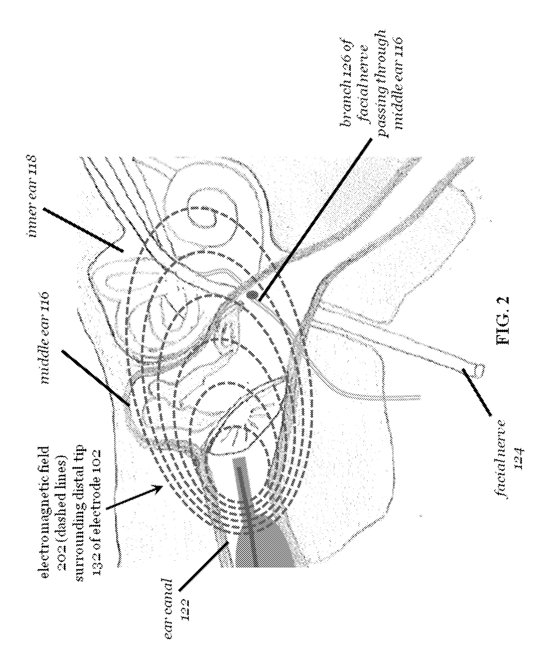 Modulating function of the facial nerve system or related neural structures via the ear