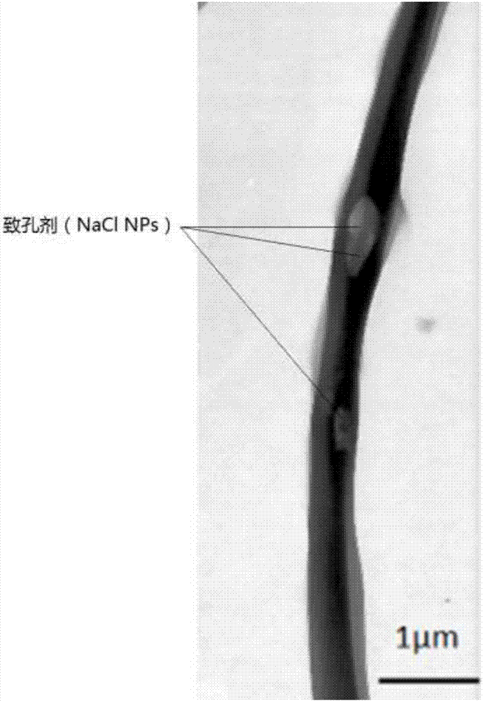 Coaxial electrospun injectable fibers and preparation method thereof