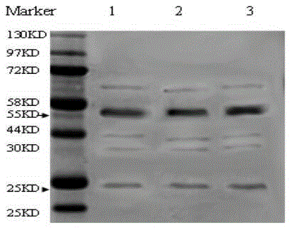 TRPC3 (Transient receptor potential cation channel, subfamily C, member 3) antigen peptide and anti-TRPC3 monoclonal antibody