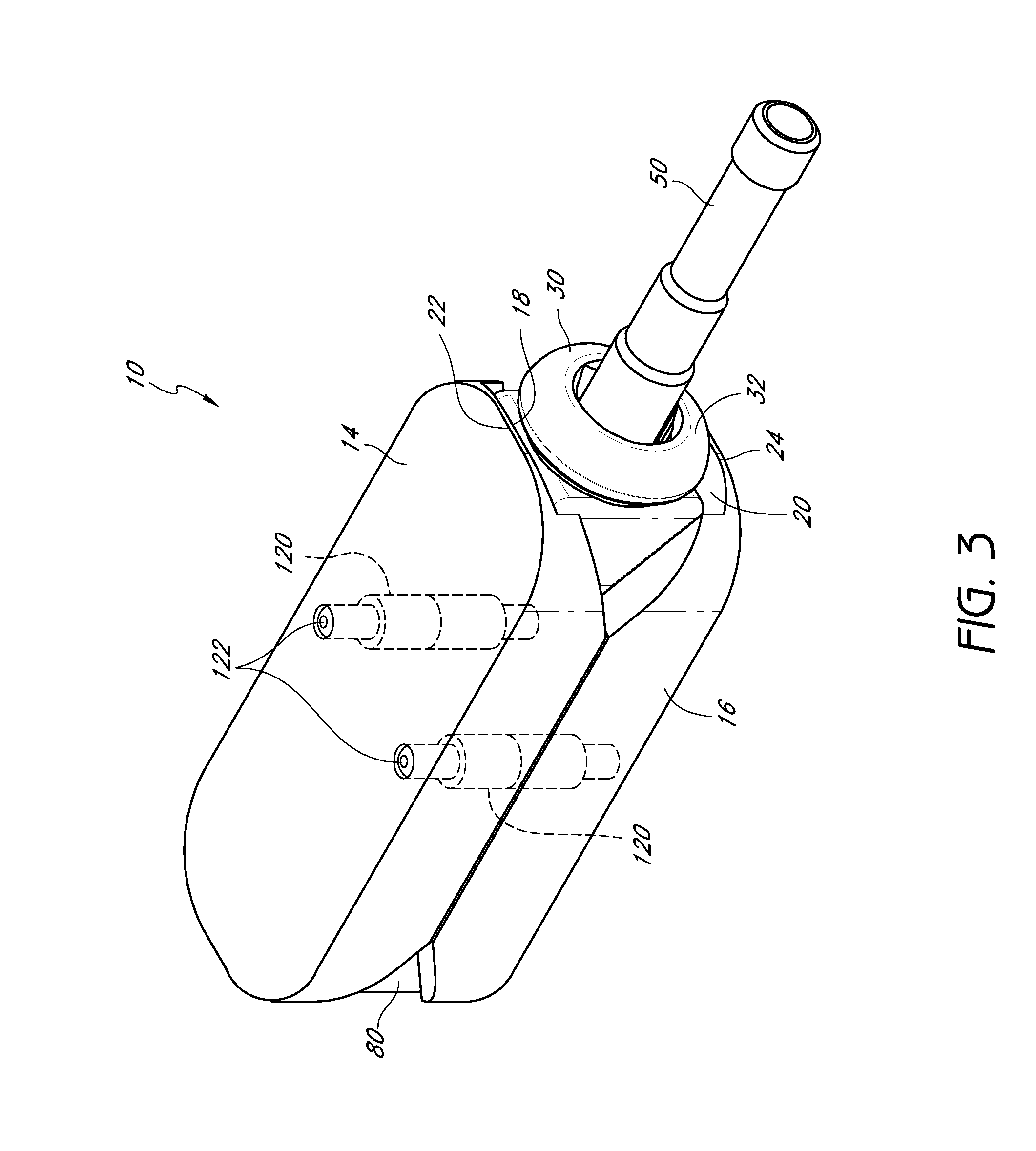 Intervertebral implant