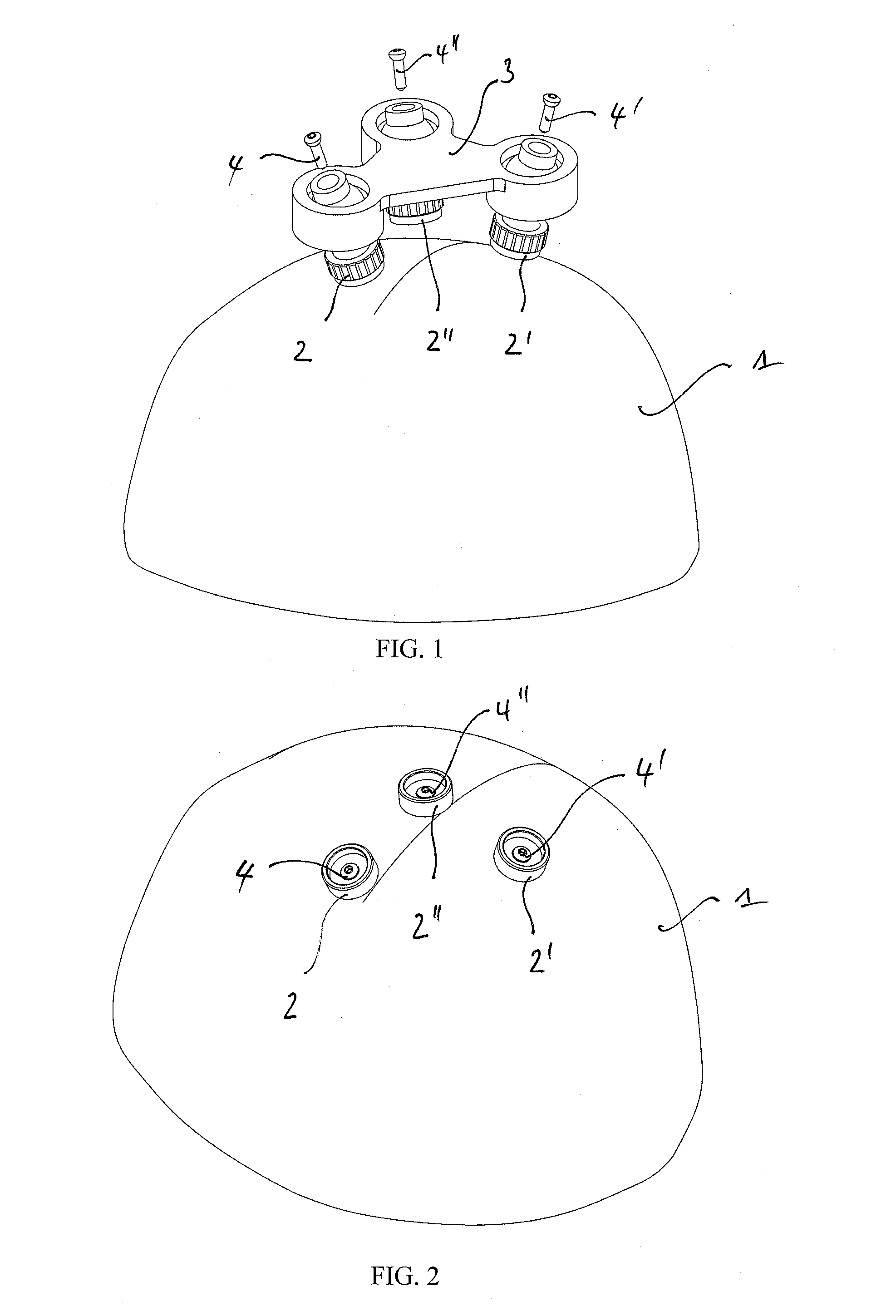 Adjustable stereotactic device and method for frameless neurosurgical stereotaxy