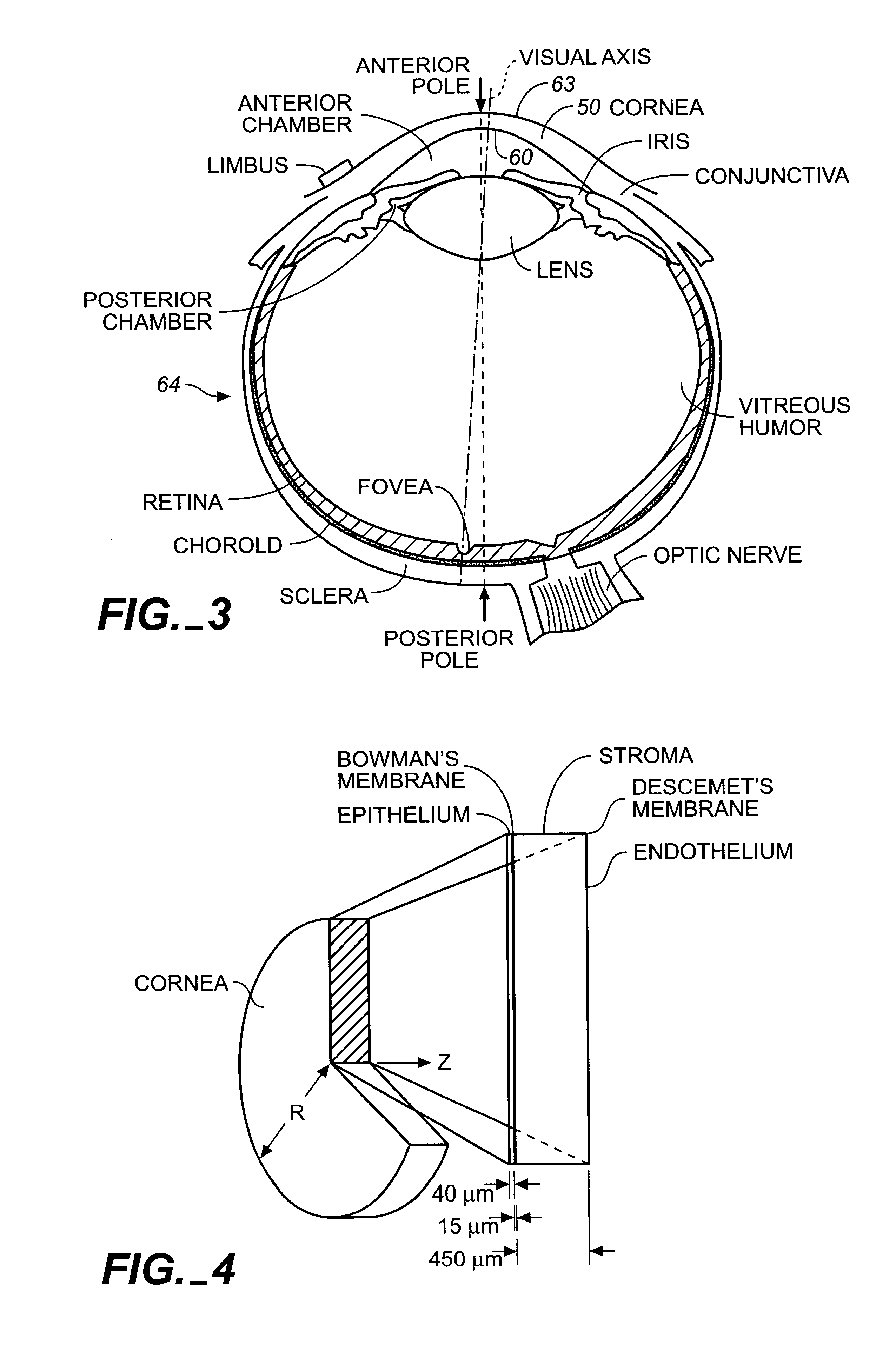 Apparatus for cornea reshaping