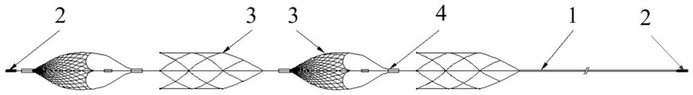 Thrombectomy