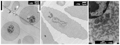 A method for blood cell collection and ultrastructural observation of sea mussels