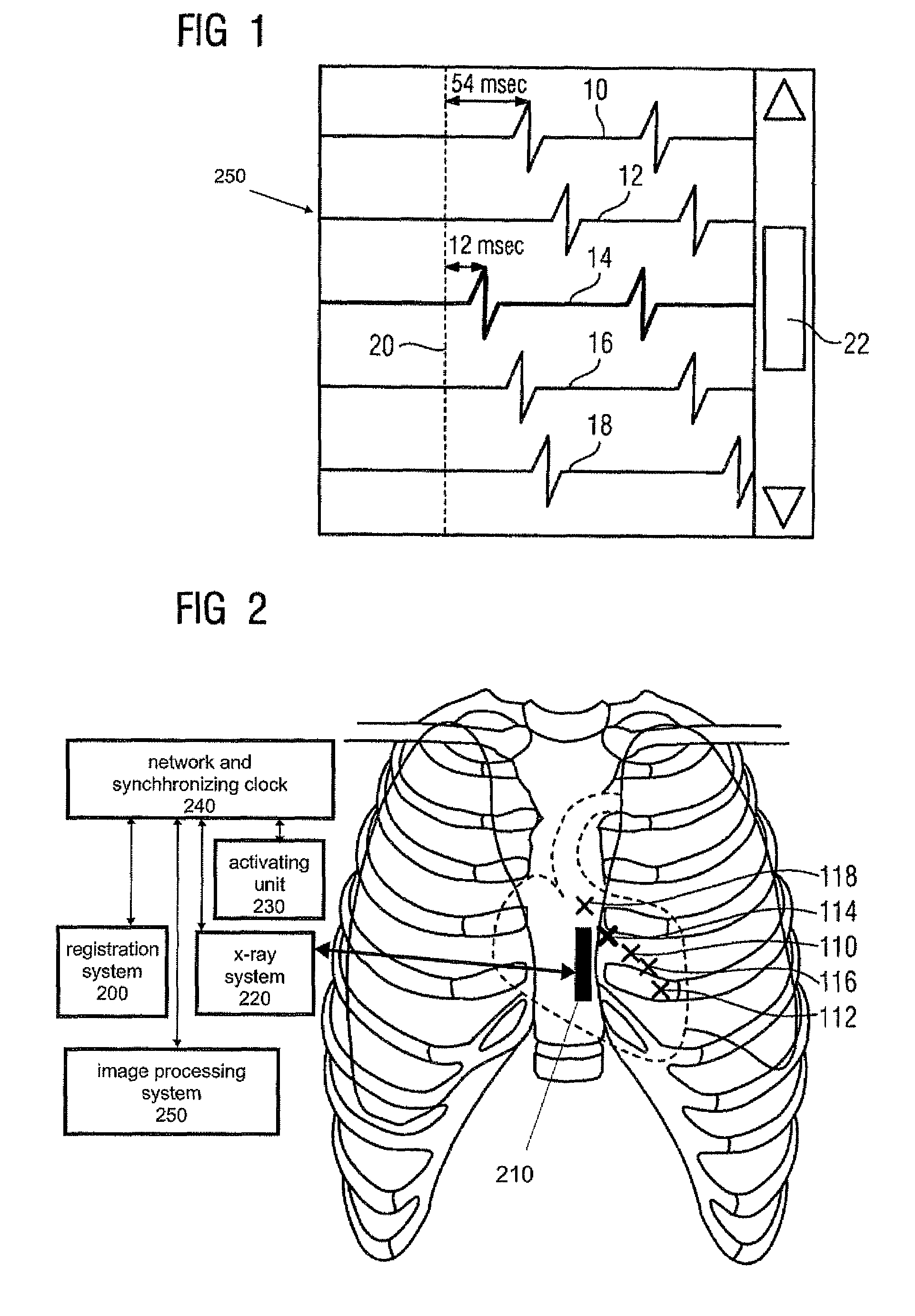 Method and system for concurrent localization and display of a surgical catheter and local electrophysiological potential curves